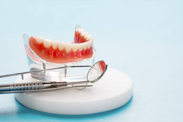 Full Mouth Reconstruction in Pensacola, FL